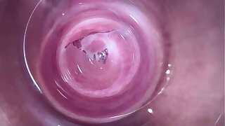 Camera deep inside teen rife with vagina