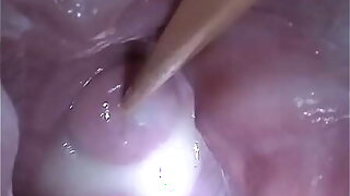 Insertion Semen Cum with respect to Cervix Wide Stretching Pussy Reflector